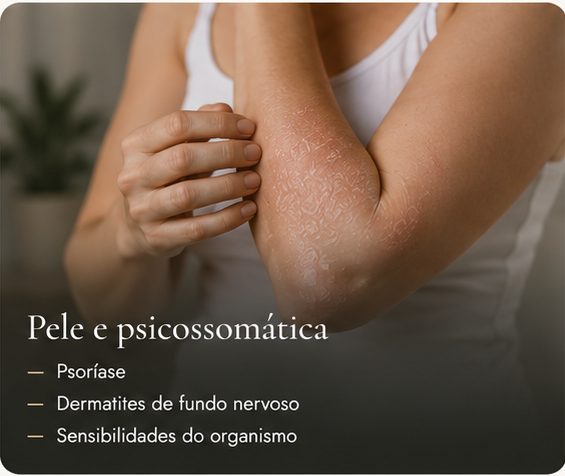 Pele e psicossomática: psoríase, dermatites de fundo nervoso, sensibilidades do organismo